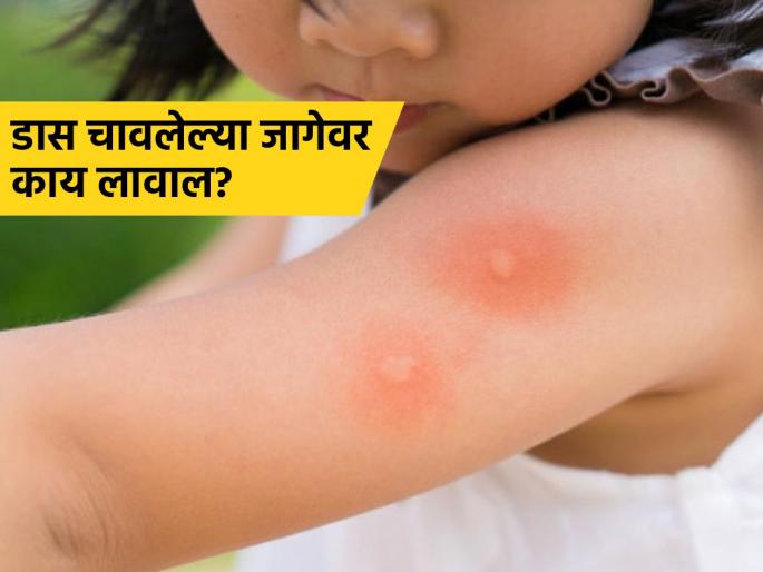 What to do if mosquitoes bite baby, doctor tells some tips | डास चावल्यामुळे अंगावर येणारी पुरळ - खाज कमी करण्यासाठी डॉक्टर सांगतात ‘हा’ उपाय