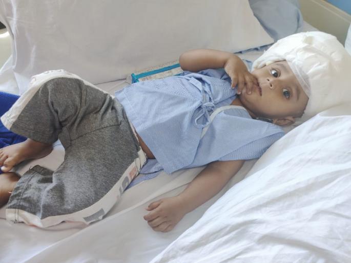 Save Life of a nine-month-old boy who suffered a skull fracture after falling from the first floor | पहिल्या मजल्यावरून पडल्याने कवटी फॅक्चर झालेल्या नऊ महिन्यांच्या मुलाला जीवनदान Save Life of a nine-month-old boy who suffered a skull fracture after falling from the first floor | पहिल्या मजल्यावरून पडल्याने कवटी फॅक्चर झालेल्या नऊ महिन्यांच्या मुलाला जीवनदान