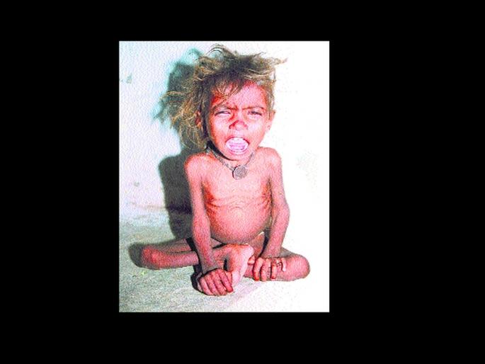 53 malnourished children in Karjat taluka | कर्जत तालुक्यामध्ये ५३ कुपोषित बालके 53 malnourished children in Karjat taluka | कर्जत तालुक्यामध्ये ५३ कुपोषित बालके