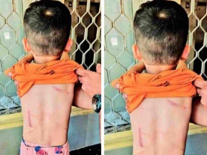 a child was given a beating in the name of a ghost a gruesome incident in Bhandup revealed couple arrested | भुताटकीच्या नावाखाली चिमुकल्याला दिले चटके, भांडुपमधील अघोरी प्रकार उघड! दाम्पत्याला अटक a child was given a beating in the name of a ghost a gruesome incident in Bhandup revealed couple arrested | भुताटकीच्या नावाखाली चिमुकल्याला दिले चटके, भांडुपमधील अघोरी प्रकार उघड! दाम्पत्याला अटक