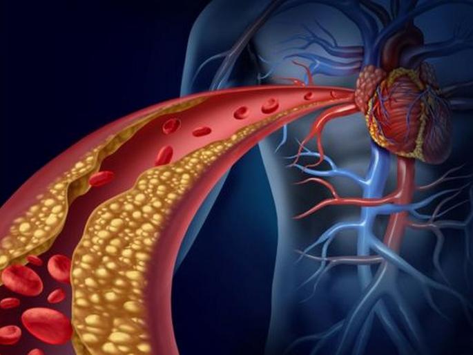 You Should know about cholesterol and heart disease | कोलेस्ट्रॉलपासून बचाव करण्यासाठी काय करावं? 'या' गोष्टी तुम्हाला माहीत असायलाच पाहिजे... You Should know about cholesterol and heart disease | कोलेस्ट्रॉलपासून बचाव करण्यासाठी काय करावं? 'या' गोष्टी तुम्हाला माहीत असायलाच पाहिजे...