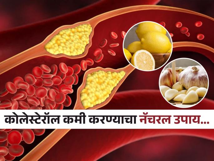 Garlic and lemon juice reduce bad cholesterol naturally calim in research | लसूण आणि लिंबाचा रस कोलेस्टेरॉल कमी करण्यासाठी ठरतो फायदेशीर, अभ्यासाचा दावा- टळतो हृदयरोगाचा धोका..
