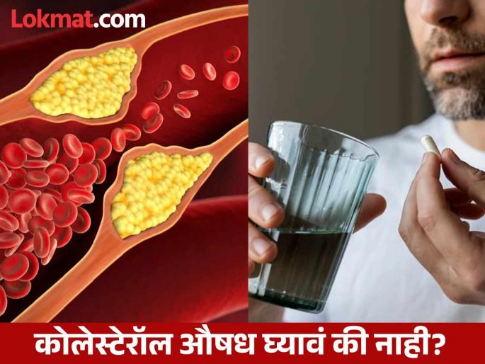 According to dietician when you should take medicine to control high cholesterol | कोलेस्टेरॉलसाठी औषधं घेणं सुरू करताय? डायटिशिअनकडून जाणून घ्या गरजेचं आहे की नाही!