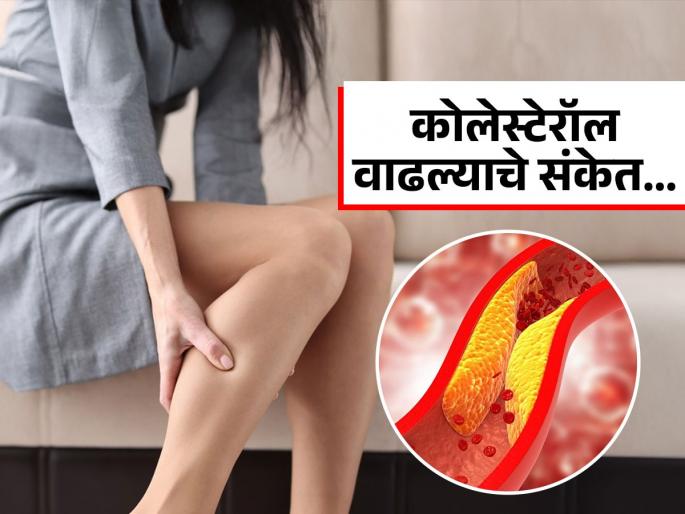 Which body part get pain when cholesterol gets high | बॅड कोलेस्टेरॉल वाढलं तर शरीरात कुठं कुठं दुखू लागतं? पाहा काय आहेत आयुर्वेदिक उपाय