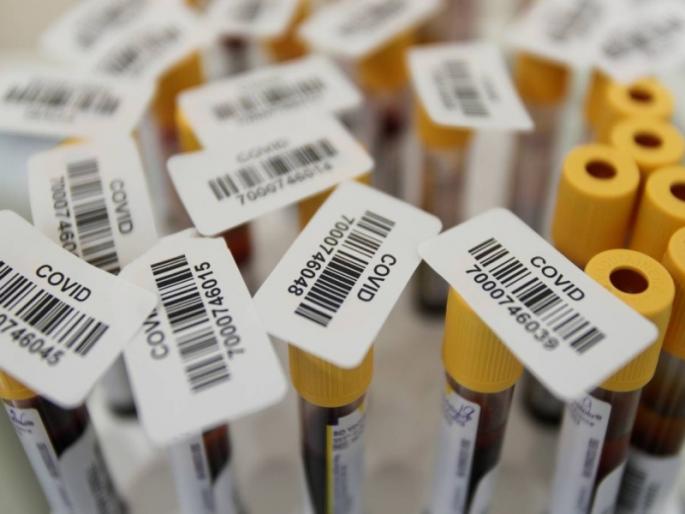CoronaVirus News: Russia has also approved the use of avifavir in the treatment of corona patients | CoronaVirus News: रशियाहून भारतासाठी शुभवार्ता; कोरोनावर 'या' औषधाचा वापर करण्यास मान्यता