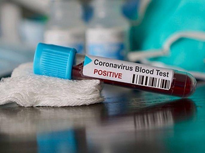 CoronaVirus Marathi News singrauli doctor sent wife's corona sample for the test as maid name, report came positive | CoronaVirus : मोलकरणीच्या नावानं पाठवलं पत्नीचं Corona सॅम्पल, रिपोर्ट आला पॉजिटिव्ह!; मग... CoronaVirus Marathi News singrauli doctor sent wife's corona sample for the test as maid name, report came positive | CoronaVirus : मोलकरणीच्या नावानं पाठवलं पत्नीचं Corona सॅम्पल, रिपोर्ट आला पॉजिटिव्ह!; मग...
