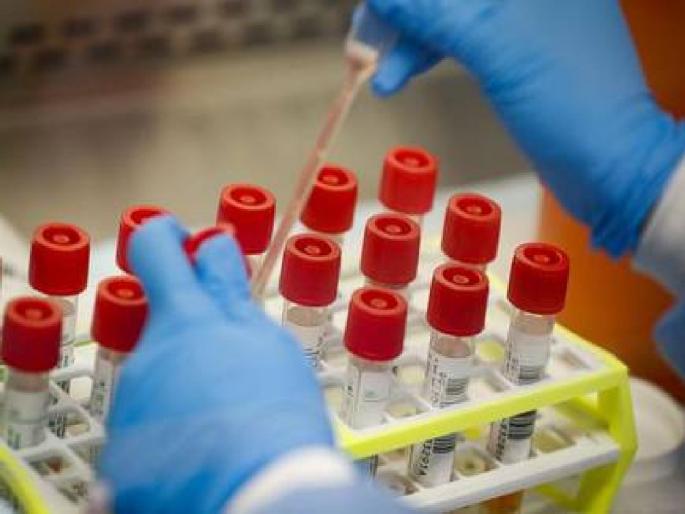 Coronavirus: Former NCP MLA infected with coronavirus; Wife's report is also positive | Coronavirus: राष्ट्रवादीच्या माजी आमदाराला कोरोनाची लागण; पत्नीचा रिपोर्टही पॉझिटिव्ह 