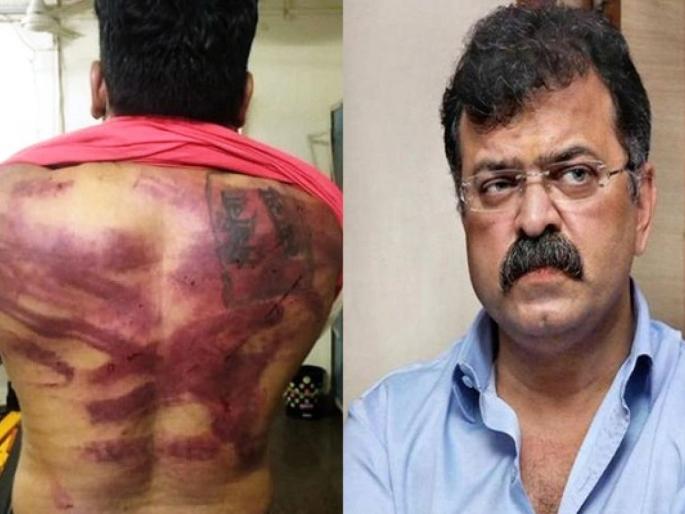 Jitendra Awhad: BJP Demand for suspension of Police who present at Awhad Bunglow when youth beaten pnm | Jitendra Awhad: जितेंद्र आव्हाड बंगल्यावरील मारहाण प्रकरण ‘त्या’ पोलिसांना भोवणार? निलंबनाची मागणी Jitendra Awhad: BJP Demand for suspension of Police who present at Awhad Bunglow when youth beaten pnm | Jitendra Awhad: जितेंद्र आव्हाड बंगल्यावरील मारहाण प्रकरण ‘त्या’ पोलिसांना भोवणार? निलंबनाची मागणी