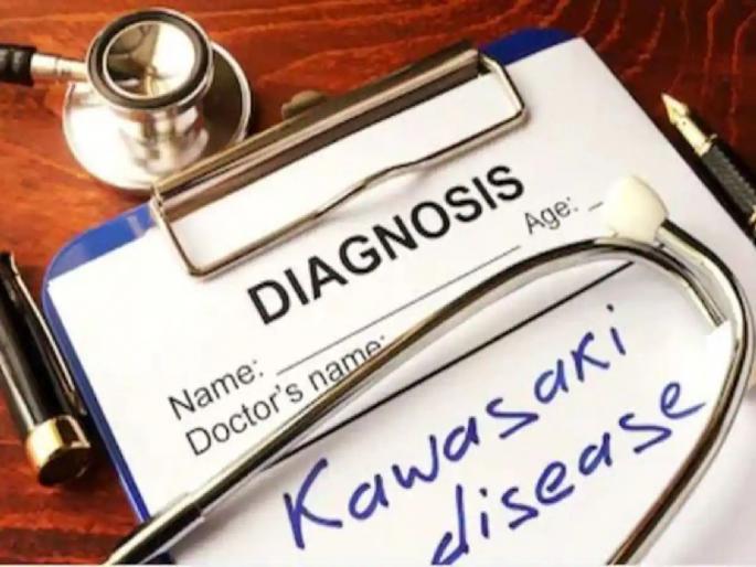Coronavirus: Understand ‘Corona’: Symptoms similar to Kawasaki disease in children | Coronavirus: समजून घ्या ‘कोरोना’: बालकांमध्ये कावासाकी आजारासारखी लक्षणे