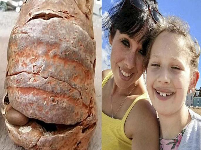 Mum and daughter, 8, lucky to be alive after WWII grenade they found on beach EXPLODED in kitchen | बापरे! समुद्रकिनारी सापडली अनोखी वस्तू; आई-लेकीनं घरी आणली अन् झाला भयंकर स्फोट Mum and daughter, 8, lucky to be alive after WWII grenade they found on beach EXPLODED in kitchen | बापरे! समुद्रकिनारी सापडली अनोखी वस्तू; आई-लेकीनं घरी आणली अन् झाला भयंकर स्फोट