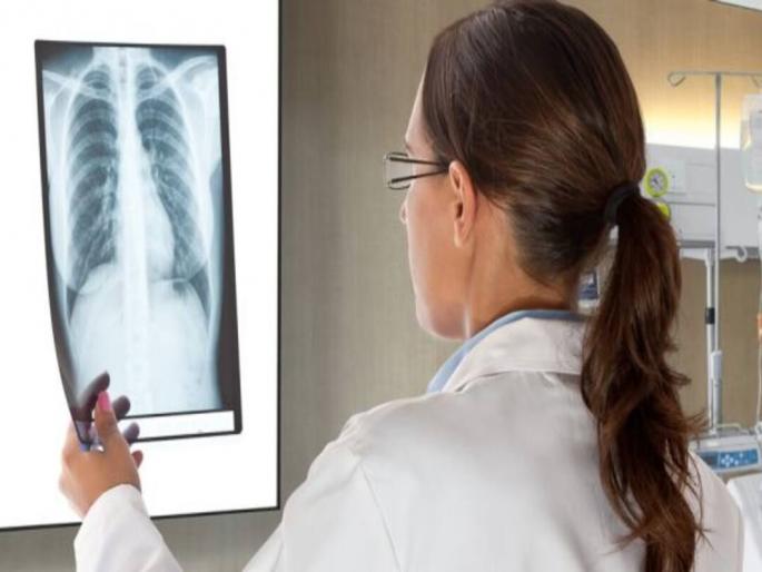 Coronavirus can be diagnosed by chest X-ray: Contribution by Gandhinagar IIT | Coronavirus: छातीच्या ‘एक्स-रे’वरूनही होणार कोरोनाचे निदान: गांधीनगर आयआयटीचे योगदान Coronavirus can be diagnosed by chest X-ray: Contribution by Gandhinagar IIT | Coronavirus: छातीच्या ‘एक्स-रे’वरूनही होणार कोरोनाचे निदान: गांधीनगर आयआयटीचे योगदान