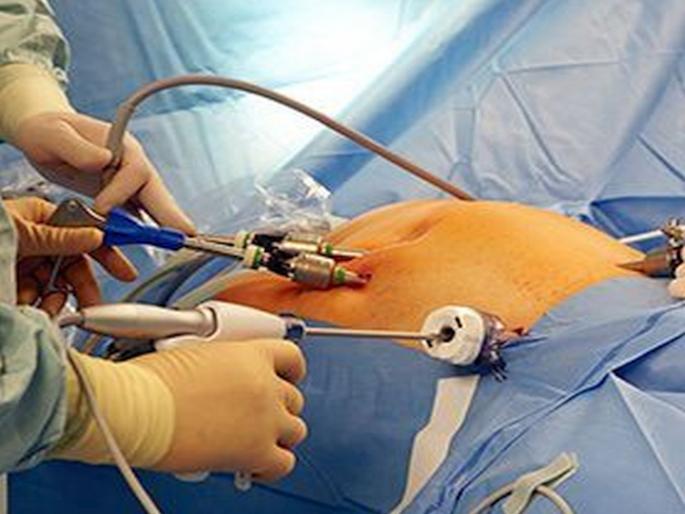 99 women are advised to remove the womb when they don't need it | ९९ महिलांना गरज नसताना  गर्भपिशवी काढायचा सल्ला 99 women are advised to remove the womb when they don't need it | ९९ महिलांना गरज नसताना  गर्भपिशवी काढायचा सल्ला