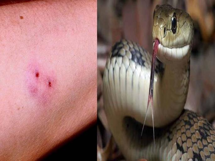 Maharashtra leads in snake bite; The highest number of snakebite incident in Nashik district | बापरे! सर्पदंशात महाराष्ट्र देशात आघाडीवर; राज्यातील 'या' जिल्ह्यात सर्वाधिक सर्पदंश Maharashtra leads in snake bite; The highest number of snakebite incident in Nashik district | बापरे! सर्पदंशात महाराष्ट्र देशात आघाडीवर; राज्यातील 'या' जिल्ह्यात सर्वाधिक सर्पदंश