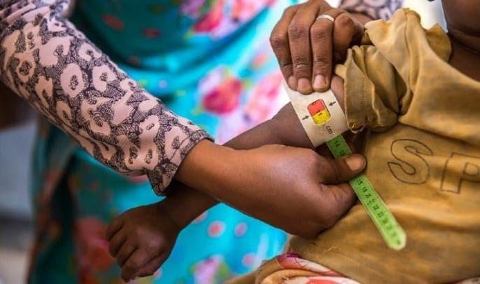 Every third child in the country is a victim of malnutrition | देशातील प्रत्येक तिसरे मूल कुपोषणाचे बळी, बिहार, झारखंड, मध्यप्र देशात अधिक प्रमाण