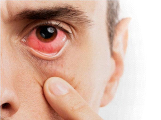 Will the eyes increase Increase in air humidity in Mumbai, appeal to take precautions to prevent infection | डोळे येण्याची साथ वाढणार? मुंबईत हवेतील आर्द्रतेत वाढ, संसर्ग टाळण्यासाठी खबरदारी घेण्याचे आवाहन