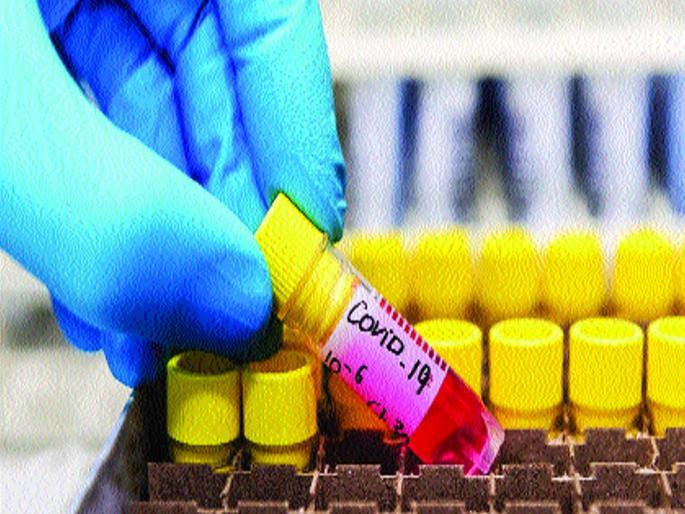 Coronavirus: Experiment on Humans for Corona Preventive Vaccines Launched in America | Coronavirus : कोरोना प्रतिबंधक लसनिर्मितीसाठी माणसांवर प्रयोगास अमेरिकेत प्रारंभ