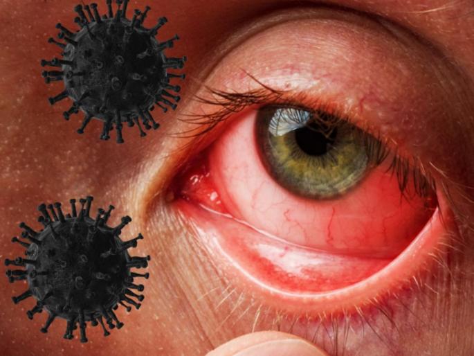 CoronsVirus Black fungus infection PIB fact check mucormycosis symptoms and treatment | फॅक्ट चेक: 'या' घरगुती उपायांनी होऊशकतो ब्लॅक फंगसवर इलाज? जाणून घ्या, व्हायरल व्हिडिओ मागील सत्य CoronsVirus Black fungus infection PIB fact check mucormycosis symptoms and treatment | फॅक्ट चेक: 'या' घरगुती उपायांनी होऊशकतो ब्लॅक फंगसवर इलाज? जाणून घ्या, व्हायरल व्हिडिओ मागील सत्य