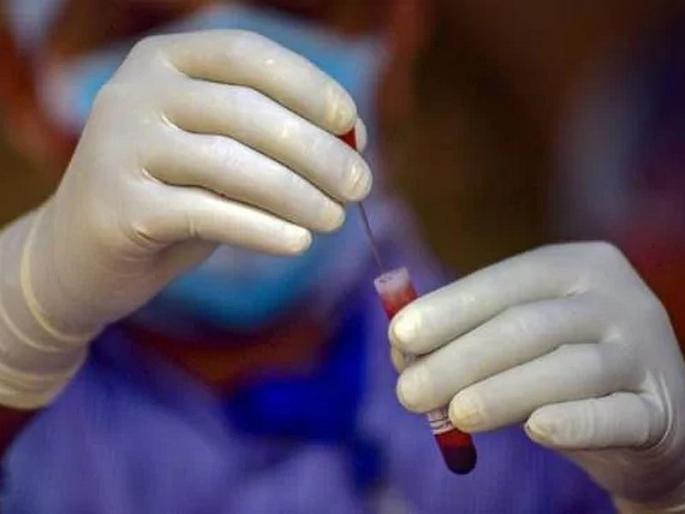 icmr says do not use rapid testing kits for two days | राजस्थानात कोरोना रॅपिड टेस्टिंग किट फेल; दोन दिवस रॅपिड टेस्ट थांबवा, ICMRची राज्यांना सूचना icmr says do not use rapid testing kits for two days | राजस्थानात कोरोना रॅपिड टेस्टिंग किट फेल; दोन दिवस रॅपिड टेस्ट थांबवा, ICMRची राज्यांना सूचना