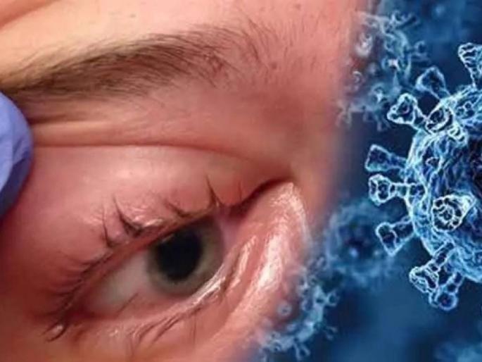 Sawangi Hospital also equipped for treatment of Mucormycosis infarction | म्युकरमायकोसिस उपचारांसाठीही सावंगी रूग्णालय सज्ज; 'ई' पंच सूत्रीचे पालन केल्यास आजारावर मात करणे सहज शक्य Sawangi Hospital also equipped for treatment of Mucormycosis infarction | म्युकरमायकोसिस उपचारांसाठीही सावंगी रूग्णालय सज्ज; 'ई' पंच सूत्रीचे पालन केल्यास आजारावर मात करणे सहज शक्य