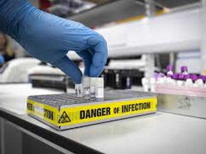 CoronaVirus: Another 35 positive in Washim district; 53 corona free | CoronaVirus : वाशिम जिल्ह्यात आणखी ३५ पॉझिटिव्ह; ५३ कोरोनामुक्त CoronaVirus: Another 35 positive in Washim district; 53 corona free | CoronaVirus : वाशिम जिल्ह्यात आणखी ३५ पॉझिटिव्ह; ५३ कोरोनामुक्त