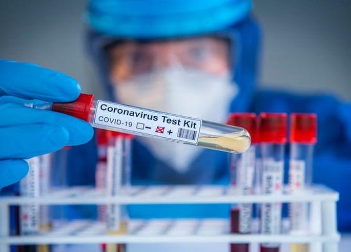 CoronaVirus In Akola 106 more overcome corona; 15 new patients were found | CoronaVirus: आणखी १०६ जणांची कोरोनावर मात; १५ नवे रुग्ण आढळले CoronaVirus In Akola 106 more overcome corona; 15 new patients were found | CoronaVirus: आणखी १०६ जणांची कोरोनावर मात; १५ नवे रुग्ण आढळले