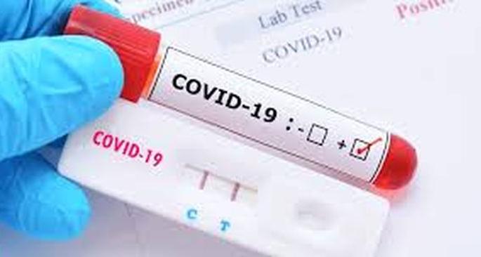 Akola district patient growth rate reduced by 15%! | अकोला जिल्ह्यात रुग्णसंख्यावाढीचा दर १५ टक्क्यांनी घटला! Akola district patient growth rate reduced by 15%! | अकोला जिल्ह्यात रुग्णसंख्यावाढीचा दर १५ टक्क्यांनी घटला!