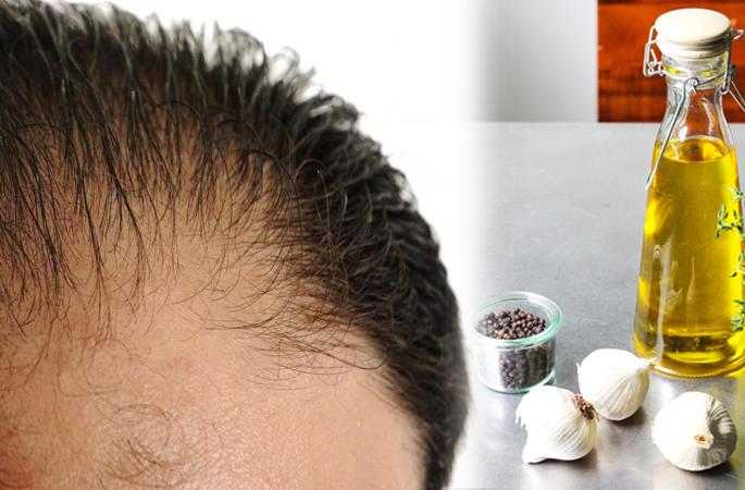 Beauty: If you want new hair on the head, then use this oil for use! | Beauty : डोक्यावर नवे केस हवे असल्यास या तेलाचा असा करा वापर !