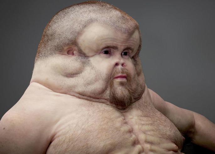 Want to get a good car accident? Then this body should be ... | ​कार अपघातातून सही-सलामत वाचायचेय? मग असे शरीर हवे...