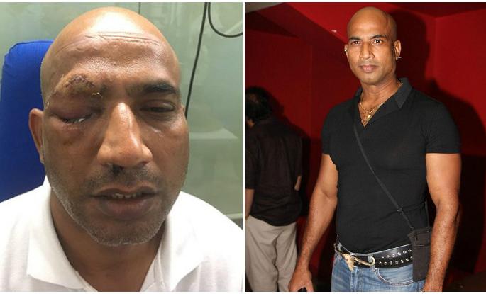 'Soldier' Fame actor Jitu Verma, doing public awareness! | डोळ्यावर आघात होऊनही खचला नाही 'सोल्जर' फेम अभिनेता जीतू वर्मा, करतो आहे जनजागृती! 'Soldier' Fame actor Jitu Verma, doing public awareness! | डोळ्यावर आघात होऊनही खचला नाही 'सोल्जर' फेम अभिनेता जीतू वर्मा, करतो आहे जनजागृती!