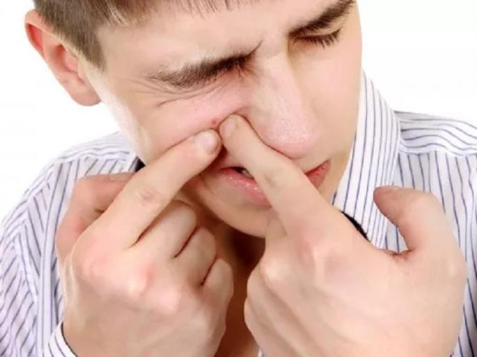 SMART TIPS: Men, make the 'Blackhead' on the face! | SMART TIPS : ​पुरुषांनो, चेहऱ्यावरील ‘ब्लॅकहेड ’असे करा दूर !