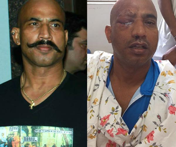 Shocking: Jitu Verma's eye saved briefly in the attack of robbers !! | Shocking : दरोडेखोरांच्या हल्ल्यात जितू वर्माचा डोळा थोडक्यात बचावला!!