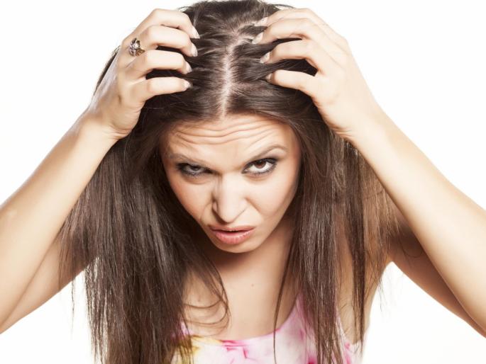 The hair is brittle! | ​केसांमध्ये कोंडा झालाय!