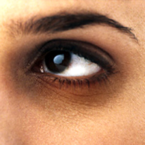 Measures to reduce the cycles under the eyes | डोळ्यांखाली वर्तुळे कमी करण्याचे उपाय