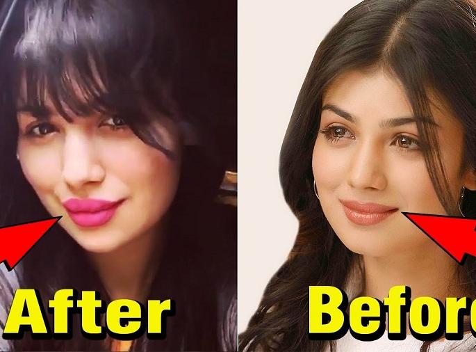 OMG !! Ayesha Takia has done lip job ... It was difficult to identify. | OMG !! ​आयशा टाकियाने केला लिप जॉब...ओळखणेही झाले कठीण!!
