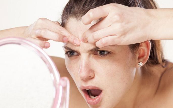 Pimples? | ​पिंपल्स झालेत?