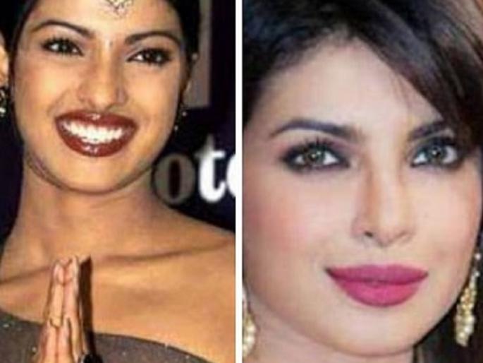 5 actresses of Bollywood have taken treatment with the Golayeta ... who are the actresses ... | बॉलिवूडच्या ‘या’ ५ अभिनेत्रींनी ट्रीटमेंट घेऊन मिळवला गोरेपणा... जाणून घ्या कोण आहेत या अभिनेत्री...