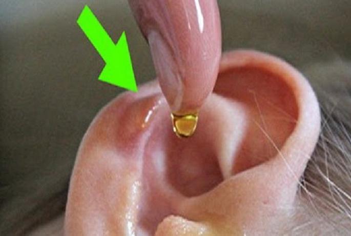 Health Tips: Clean the ear with these easy remedies! | Health Tips : ​कानाची सफाई करा ‘या’ सोप्या उपायांनी !