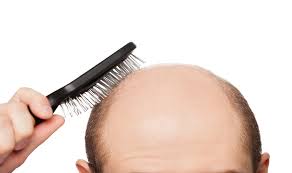 If you do not have any baldness! | ​.. तर टक्कल पडणार नाही!