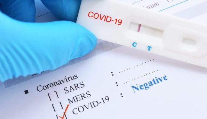 Eight people return from Britain to Akola; All reports are negative | ब्रिटनहून आठ जण अकोल्यात दाखल; सर्वांचे अहवाल निगेटिव्ह Eight people return from Britain to Akola; All reports are negative | ब्रिटनहून आठ जण अकोल्यात दाखल; सर्वांचे अहवाल निगेटिव्ह