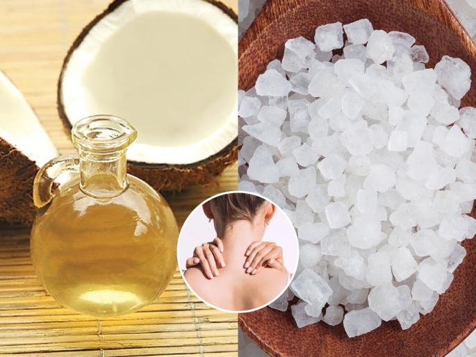 A special remedy, mix coconut oil and camphor, an effective treatment for many diseases | १ चमचा खोबरेल आणि चिमूटभर कापराचा खास उपाय-डोक्यापासून पायाच्या नखापर्यंतच्या अनेक आजारांवर असरदार इलाज