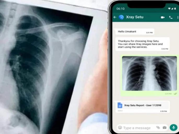 Reading X-ray via WhatsApp: AI-driven 'XraySetu' helps doctors detect Corona in rural area | CoronaVirus: व्हॉट्सअॅपवर एक्स-रे पाठवा, कोरोना आहे की नाही ते कळेल; मोफत XraySetu सेवा लाँच Reading X-ray via WhatsApp: AI-driven 'XraySetu' helps doctors detect Corona in rural area | CoronaVirus: व्हॉट्सअॅपवर एक्स-रे पाठवा, कोरोना आहे की नाही ते कळेल; मोफत XraySetu सेवा लाँच