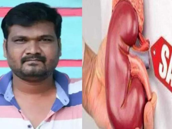 Karnataka Bus Conductor Puts Kidney On Sale To Meet Financial Needs | ...म्हणून 'त्या' बस कंडक्टरनं सोशल मीडियावर स्वत:ची किडनी विकायला काढली Karnataka Bus Conductor Puts Kidney On Sale To Meet Financial Needs | ...म्हणून 'त्या' बस कंडक्टरनं सोशल मीडियावर स्वत:ची किडनी विकायला काढली