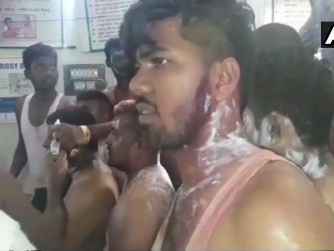 10 injured in acid attack on congress victory rally in tumkur karnataka | काँग्रेसच्या विजयी मिरवणुकीवर अॅसिड हल्ला; 10 कार्यकर्ते जखमी 10 injured in acid attack on congress victory rally in tumkur karnataka | काँग्रेसच्या विजयी मिरवणुकीवर अॅसिड हल्ला; 10 कार्यकर्ते जखमी