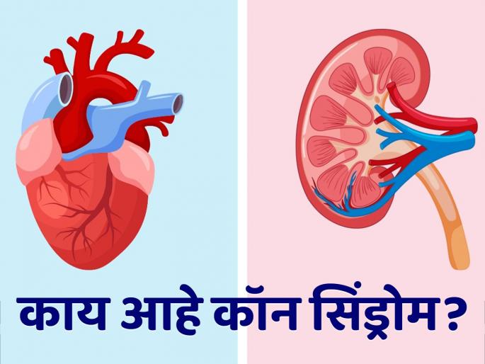 What is conn syndrome? know how its effect kidney and heart | काय आहे कॉन सिंड्रोम, जो किडनी आणि हृदयावर एकत्र करतो गंभीर प्रभाव? What is conn syndrome? know how its effect kidney and heart | काय आहे कॉन सिंड्रोम, जो किडनी आणि हृदयावर एकत्र करतो गंभीर प्रभाव?