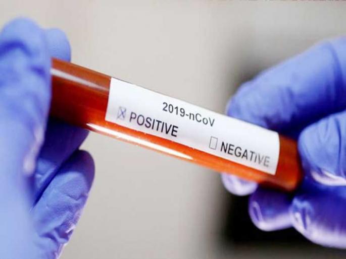 The Rupinagar area in Pimpri is now a Corona hotspot; So far 34 patients have been found | पिंपरीतील रुपीनगर परिसर आता कोरोना हॉटस्पॉट; आतापर्यंत आढळले ३४ रुग्ण The Rupinagar area in Pimpri is now a Corona hotspot; So far 34 patients have been found | पिंपरीतील रुपीनगर परिसर आता कोरोना हॉटस्पॉट; आतापर्यंत आढळले ३४ रुग्ण