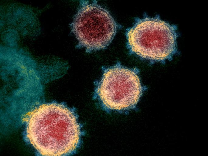 coronavirus: coronavirus crosses 700; 34 new patients in Jalana | coronavirus : जालन्यात कोरोना ७०० पार; ३४ नवीन रूग्ण