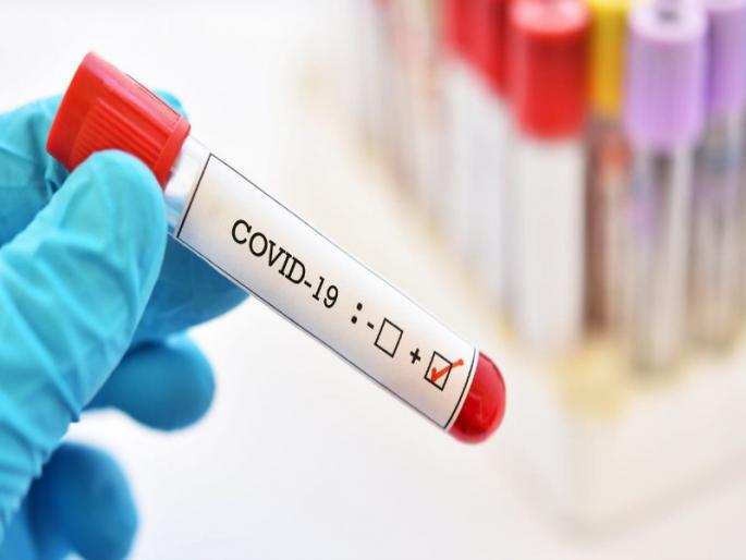 Corona Virus News: 766 new corona cases in Pune on Thursday; 391 people defeated Corona | Corona Virus News : पुणे शहरात गुरूवारी ७६६ नव्या कोरोनाबाधितांची वाढ; ३९१ जणांची कोरोनावर मात Corona Virus News: 766 new corona cases in Pune on Thursday; 391 people defeated Corona | Corona Virus News : पुणे शहरात गुरूवारी ७६६ नव्या कोरोनाबाधितांची वाढ; ३९१ जणांची कोरोनावर मात