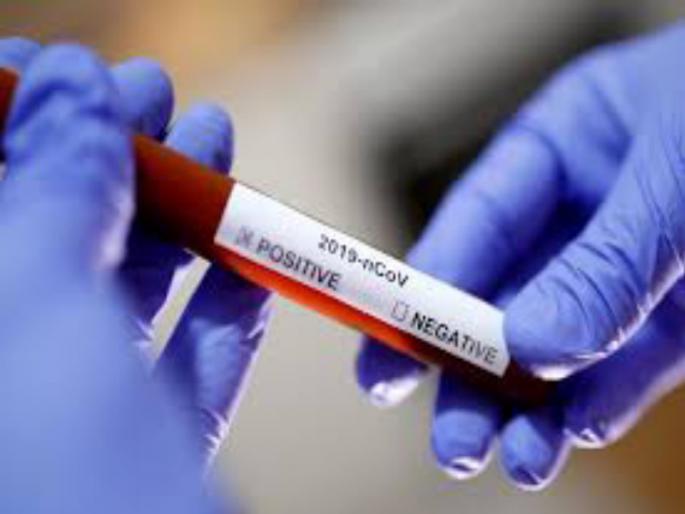 coronavirus: an increase of 75 coronavirus patients; The total number of patients is 17 thousand 125 | coronavirus : कोरोनाबाधित ७५ रुग्णांची वाढ; एकूण रुग्णसंख्या १७ हजार १२५ वर