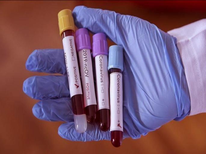 coronavirus: 11 thousand 420 corona patients in Aurangabad district; An increase of 179 new patients | coronavirus : औरंगाबाद जिल्ह्यात कोरोना रुग्णसंख्या ११ हजार ४२०; १७९ नव्या रुग्णांची वाढ coronavirus: 11 thousand 420 corona patients in Aurangabad district; An increase of 179 new patients | coronavirus : औरंगाबाद जिल्ह्यात कोरोना रुग्णसंख्या ११ हजार ४२०; १७९ नव्या रुग्णांची वाढ