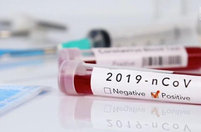 Employees of Kasturba Hospital in Sevagram tested positive | सेवाग्रामच्या कस्तुरबा दवाखान्यातील कर्मचारी निघाला कोरोना पॉझिटिव्ह Employees of Kasturba Hospital in Sevagram tested positive | सेवाग्रामच्या कस्तुरबा दवाखान्यातील कर्मचारी निघाला कोरोना पॉझिटिव्ह